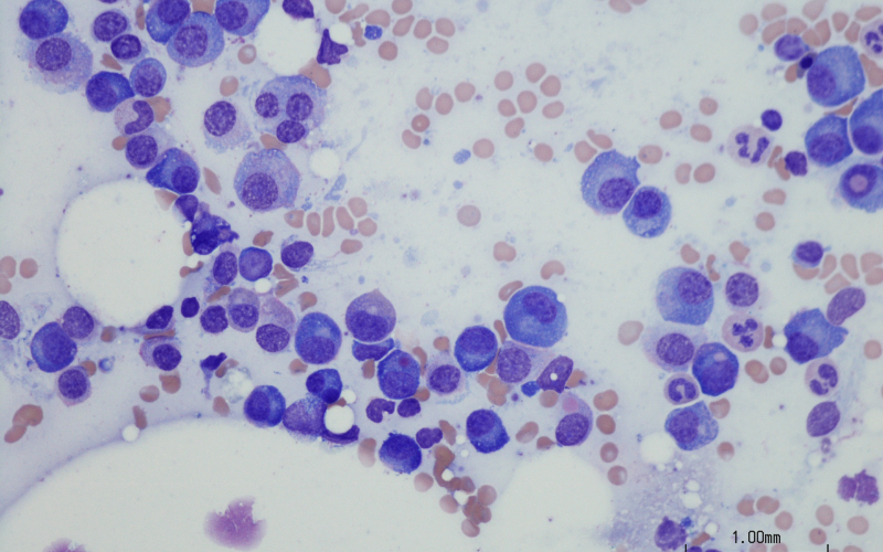 Bone Marrow