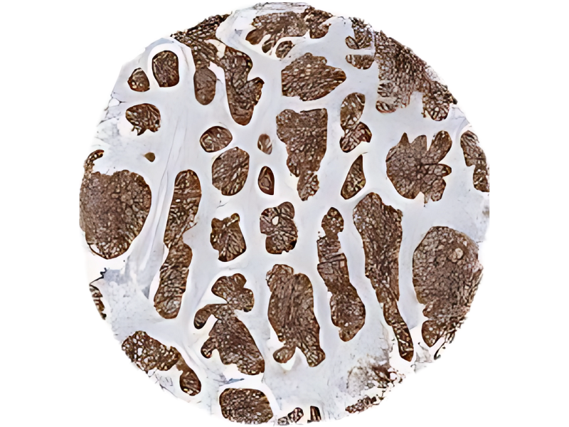 CD45RA+ T Cells
